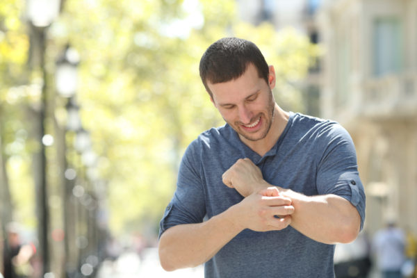 Adult man scratching itchy arm in the street