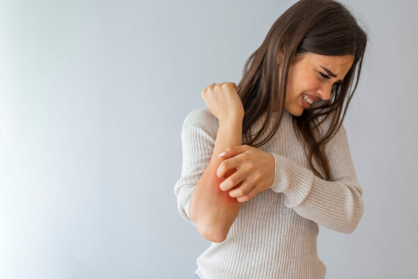 Woman scratching her arm